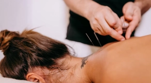Akupunktura – Twój naturalny sposób na zdrowie! Przed Tobą garść ważnych informacji