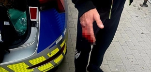 Ślady krwi na klatce schodowej doprowadziły policjantów do rannego mężczyzny