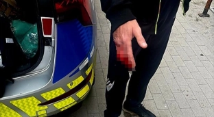 Ślady krwi na klatce schodowej doprowadziły policjantów do rannego mężczyzny